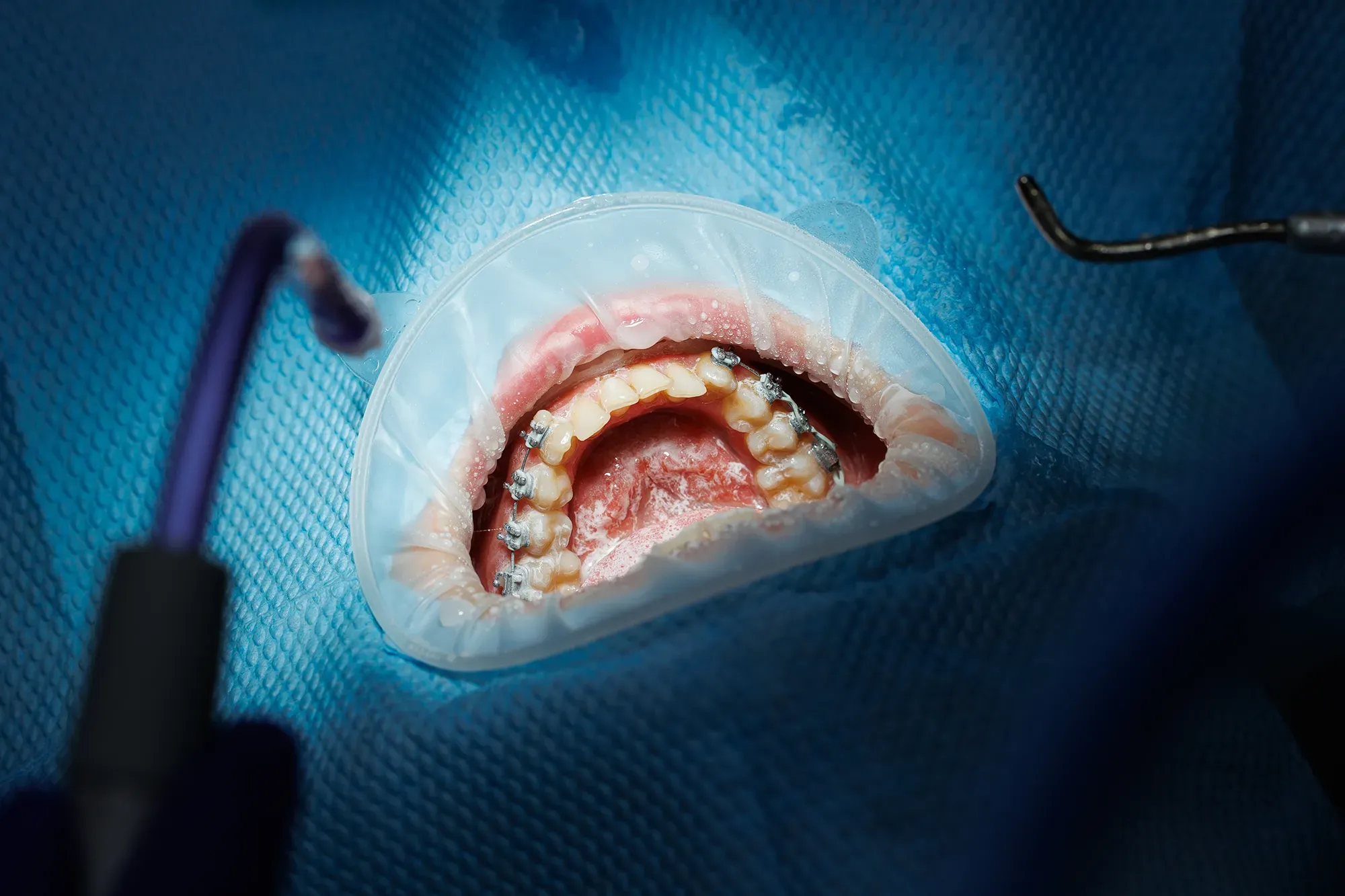Microsurgery