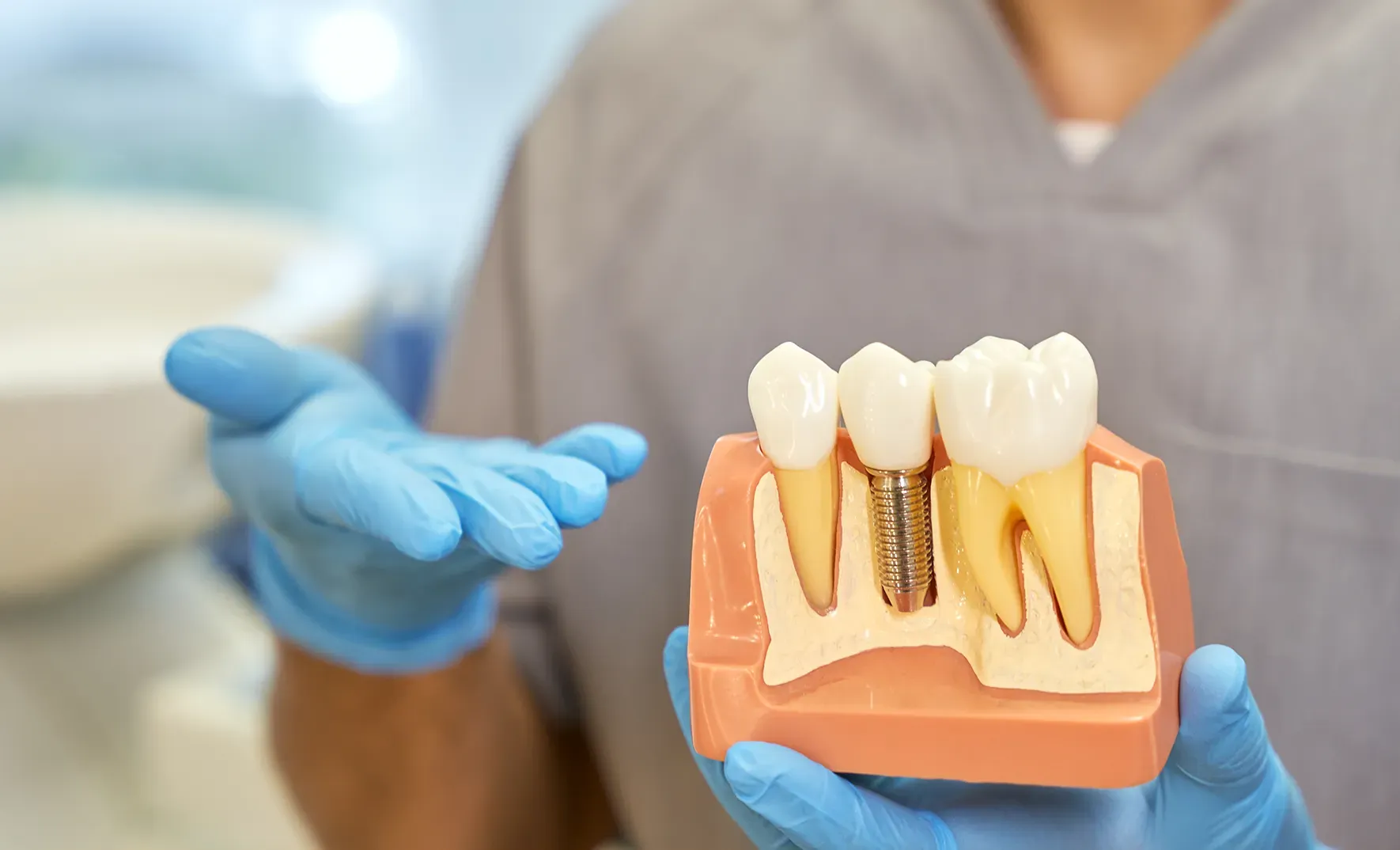 A replacement that behaves like a tooth
